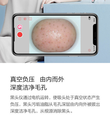 小米有品媄拾智能可視吸黑頭儀 告別黑頭，開啟“眼見為實”的清潔新時代